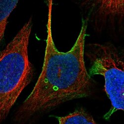 ZFP90 Antibody, Novus Biologicals:Antibodies:Primary Antibodies